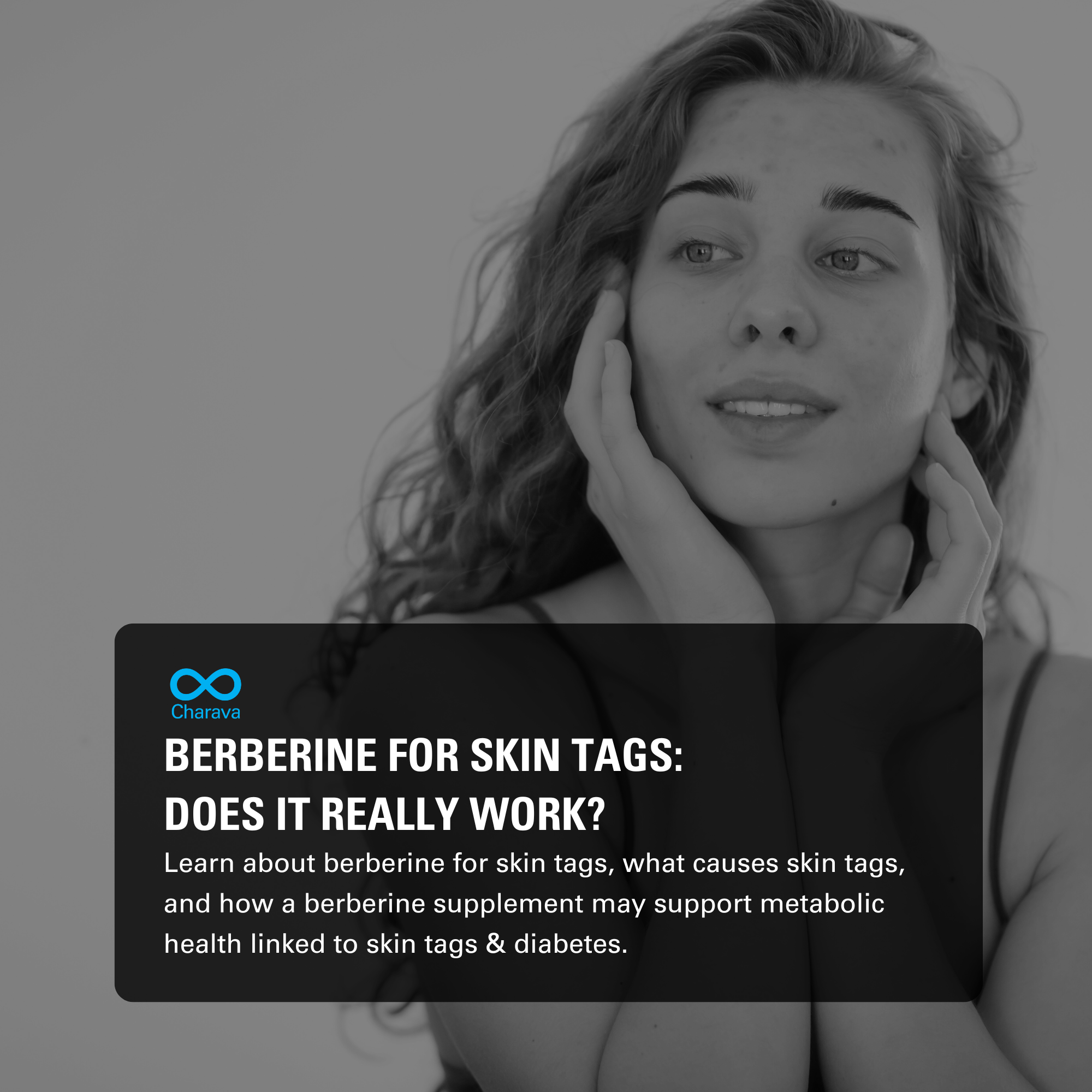 Berberine for Skin Tags: Benefits, Uses and Safety Tips to Know - Charava UK