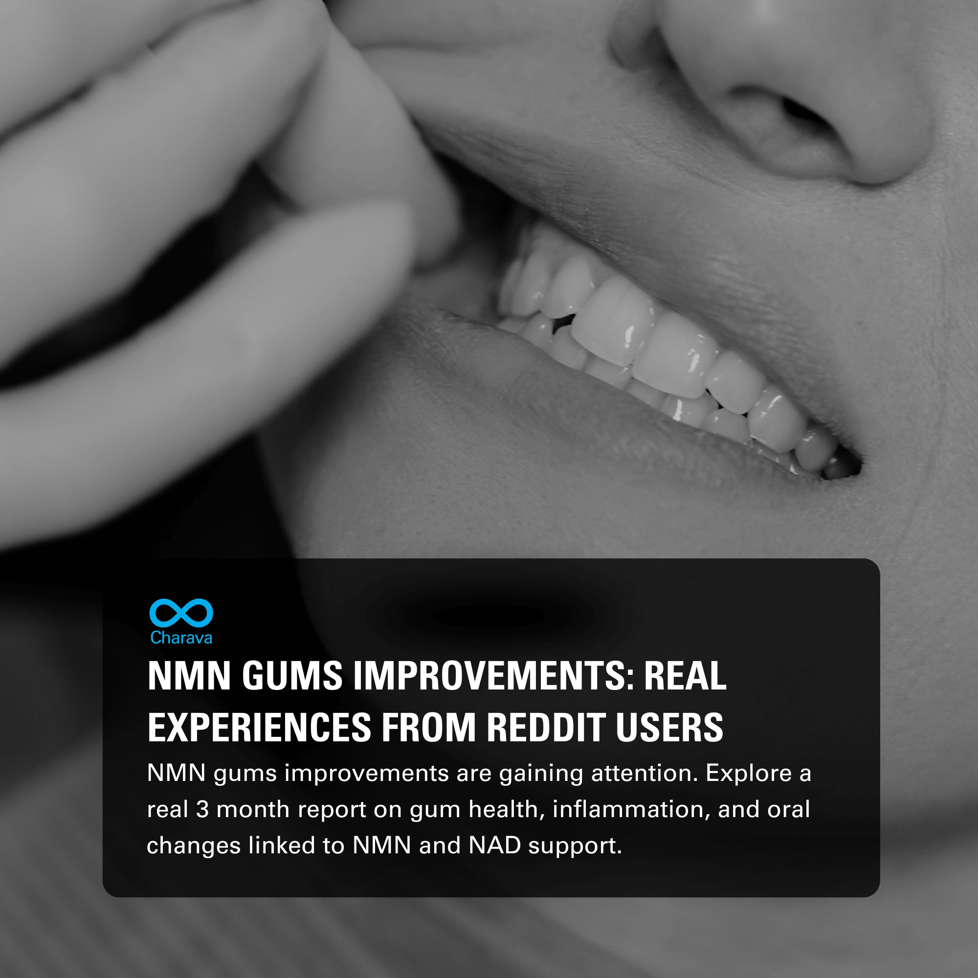Effect of NMN on Gums Improvements: Reddit User Sees Real Changes - Charava UK